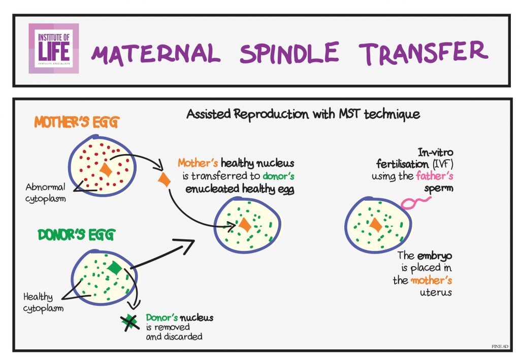 Description with drawing maternal spindle transfer with Iolife logo