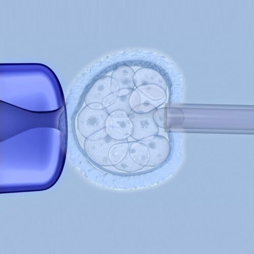 1-Blastocysts Biopsy